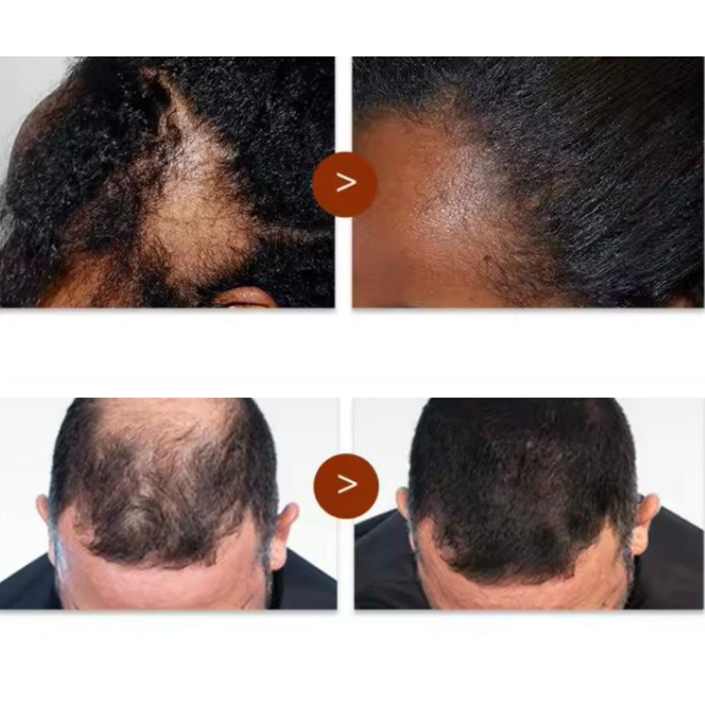 PURC Tratamiento de Crecimiento Capilar – Estimula el crecimiento del cabello