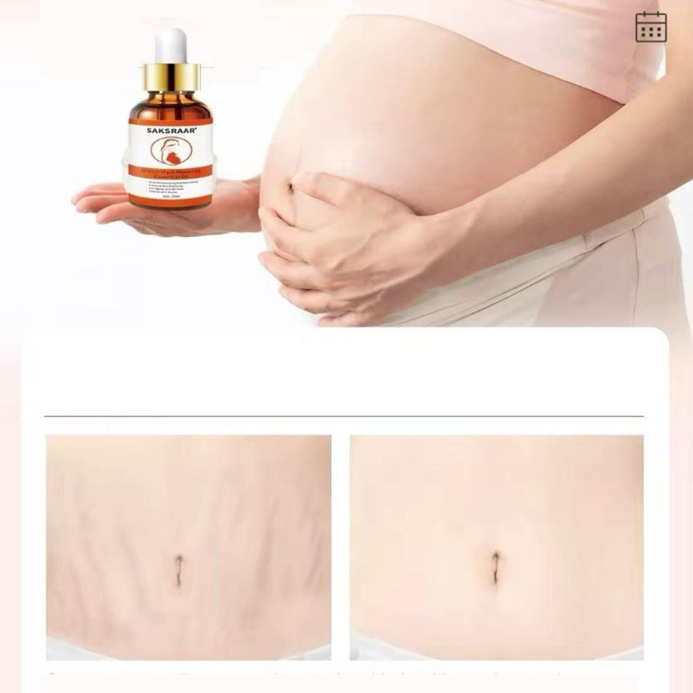 Aceite Antiestrías - Saksraar
