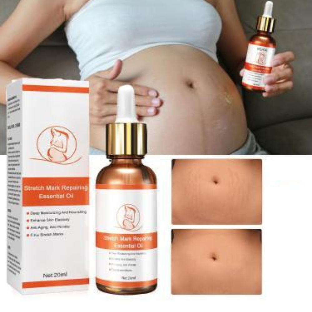 Aceite Antiestrías - Saksraar