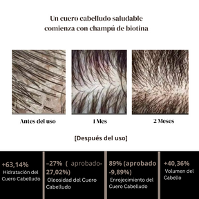 PURC Tratamiento de Crecimiento Capilar – Estimula el crecimiento del cabello