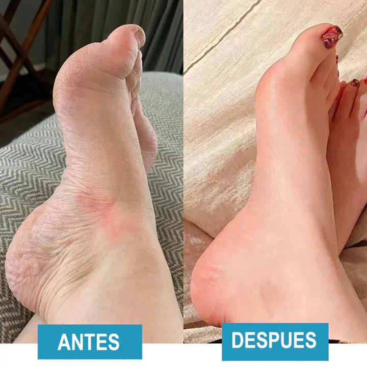 Masajeador de Pies – Relajante, Alivio de Dolor y Profundo